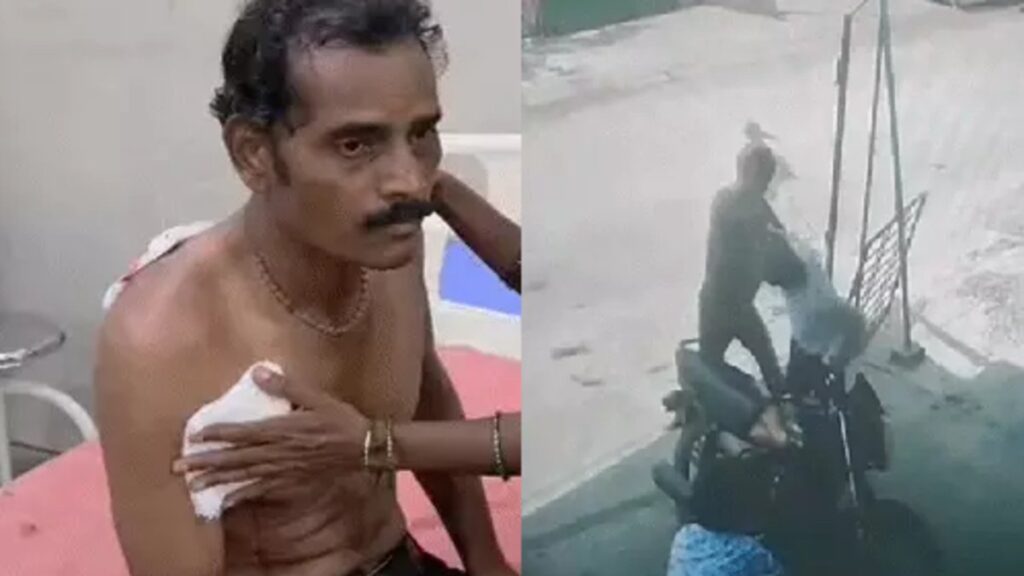 CG CRIME : प्रपोजल ठुकराने पर आरोपी का खौफनाक कदम, पिता को किया लहूलुहान