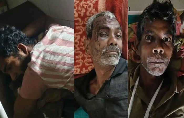 खेत में मवेशी घुसने पर ग्रामीण-चरवाहों में खूनी संघर्ष: एक चरवाहे के कमर में घुसा तीर, दो अन्य घायल खेत में मवेशी घुसने पर ग्रामीण-चरवाहों में खूनी संघर्ष: एक चरवाहे के कमर में घुसा तीर, दो अन्य घायल