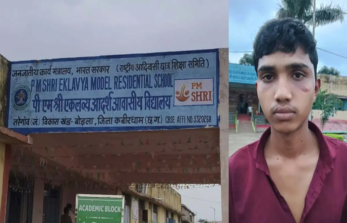 एकलव्य आवासीय छात्रावास में जूनियर छात्र की पिटाई, सीनियर छात्रों पर कमरे में बंद कर मारपीट का आरोप एकलव्य आवासीय छात्रावास में जूनियर छात्र की पिटाई, सीनियर छात्रों पर कमरे में बंद कर मारपीट का आरोप